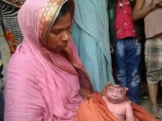 <b>印度女子产下无脑巨眼婴儿 当地人当做神明特意前去朝拜</b>