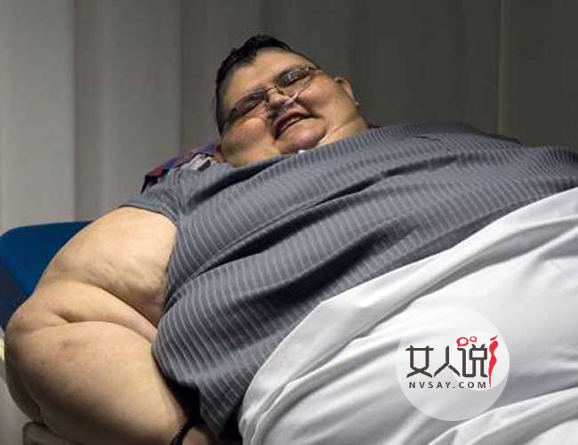 男子重达590公斤 喝水都吸收并发症多常年卧床惨不忍睹