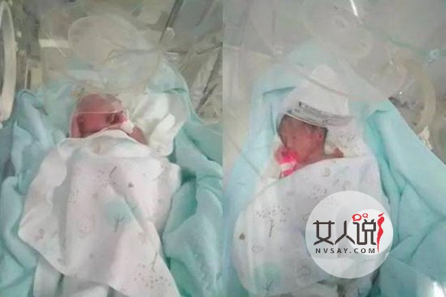 双胞胎后生双胞胎 因早产体弱住进重症监护室牵动全城心