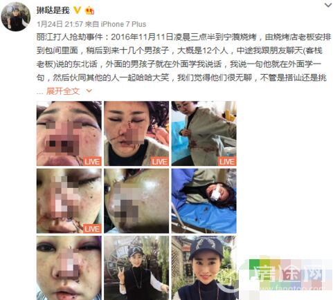 丽江遭殴打女游客与6名被告人达和解 女子丽江被打毁容真相是什么
