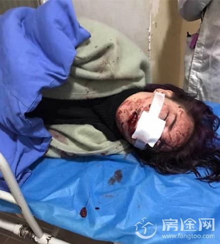 丽江遭殴打女游客与6名被告人达和解 女子丽江被打毁容真相是什么