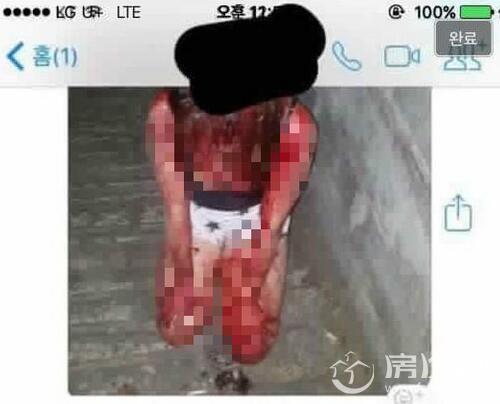 女学生施暴照片震惊韩社会:受害人全身被血染红惨不忍睹 数万人请愿严惩施暴少女