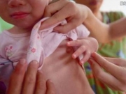 1岁女婴乳房“发育” 竟因步入“微小青春期”