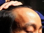 世界各国秃头率相关调查 日本亚洲第一