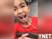 越南小男孩发明新型拔牙方式：用弓箭拔牙 效果还不错