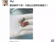 <b>19岁幼师被勒断了两根手指 事故原因竟是美甲惹的祸</b>