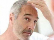 治疗白头发的小偏方 让白发轻松变成黑发的方法