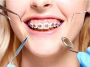 绑牙齿的危害后果有哪些 你准备好承担这些一辈子的后果了吗