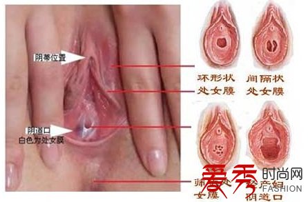 阴道图片