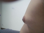 男性乳腺增生是怎么回事 什么原因导致乳腺增生