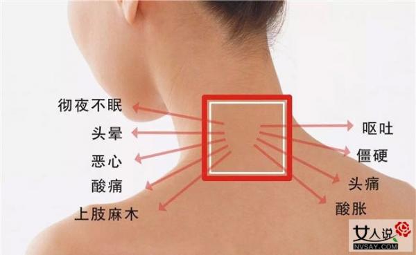 颈椎病的症状 知道这些症状自己也能判断颈椎病