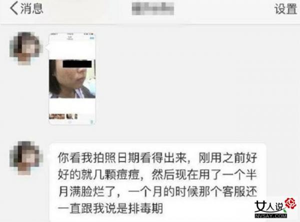 张庭回应投诉 女客户脸部被毁吓坏观众疑系故意陷害