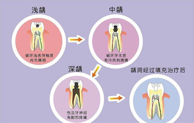 嘴里放青蛙治牙疼 10岁小孩龋齿被家长抓青蛙放嘴里“捉虫子”