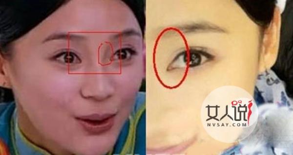 袁姗姗整容前后照片对比 姗宝青涩照片曝光网友直呼辣眼睛
