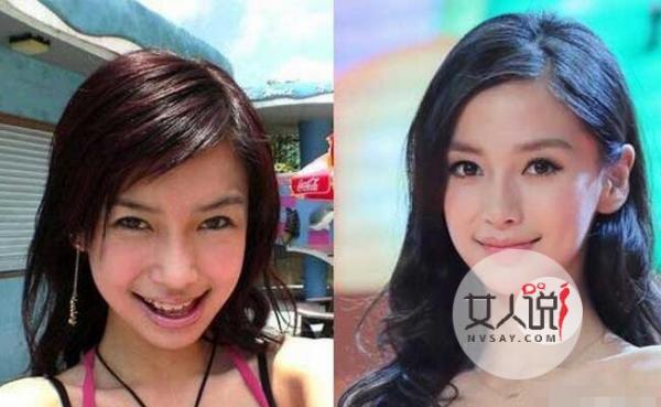 盘点整容像换头的明星 女星昔日旧照丑瞎众人残女变美女