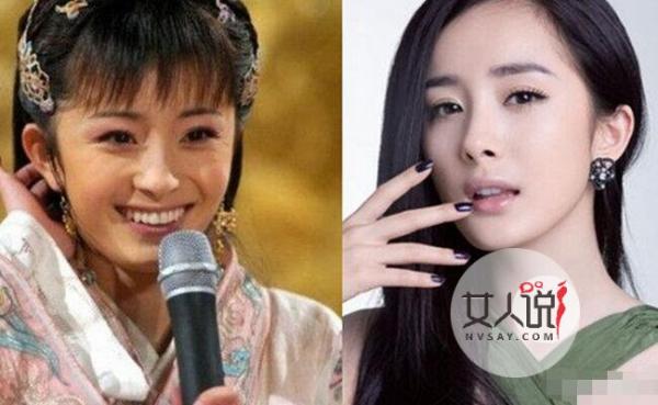盘点整容像换头的明星 女星昔日旧照丑瞎众人残女变美女