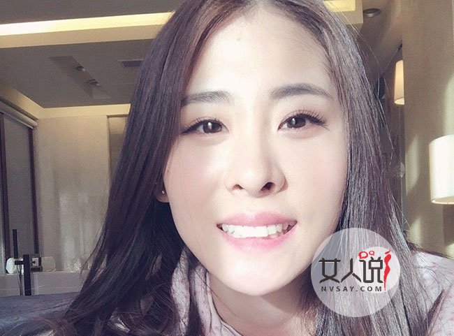 张碧晨整容前后照片对比 昔日丑女秒变大美人可谓判若两人