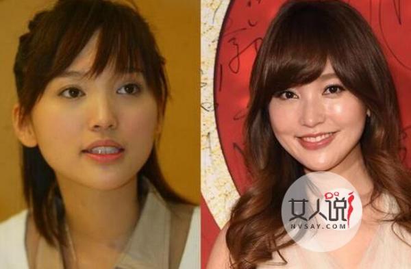 金莎14年后大变脸 整容前后照被扒昔日清纯玉女变熟女