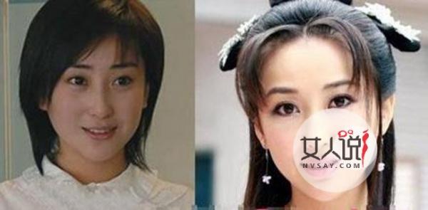 杜晓婷整容前后对比 经过整容刀的雕刻摇身秒变美少女
