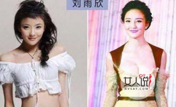 刘雨欣整容前后照片 励志女神为夺渣男初心肆无忌惮换脸