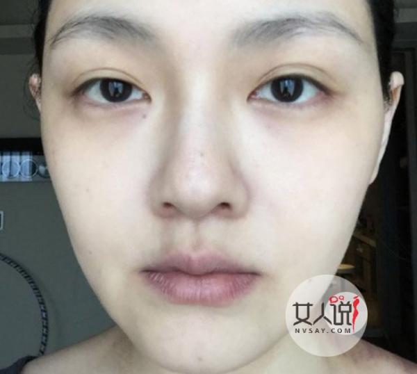大S产后正式复工 辣妈整容过度笑脸僵硬看起来很恐怖