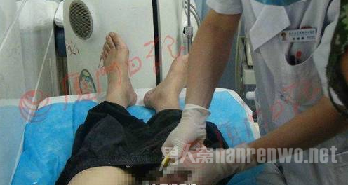 如厕裤链卡下体