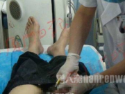 男子上厕所命根子被拉链卡住 消防员出手救“傻逼”