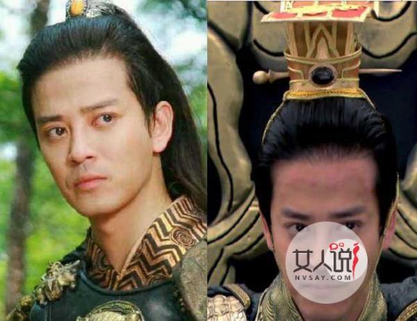 陈晓东额头怎么了 揭兰陵王中的宇文邕额头溃烂内幕