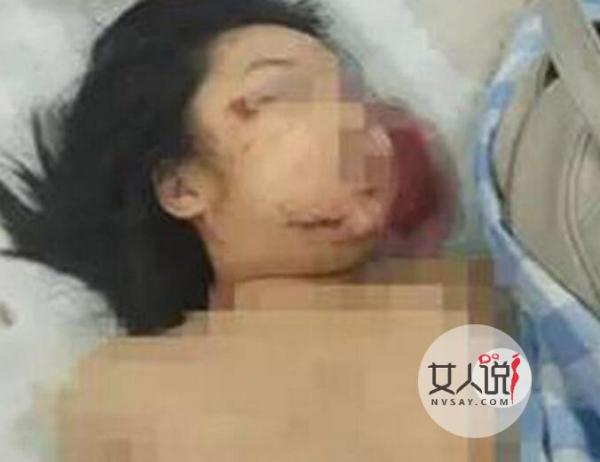 女童课间离奇惨死 黑色6分钟揭女童死亡背后真因