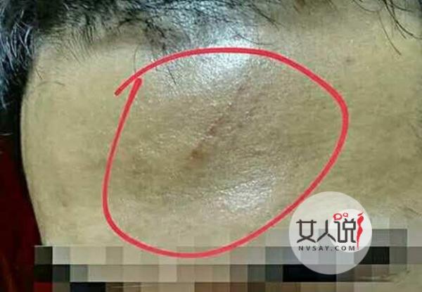 吓尿！餐馆天降活老鼠 男子脸上血痕让人看得很恐怖