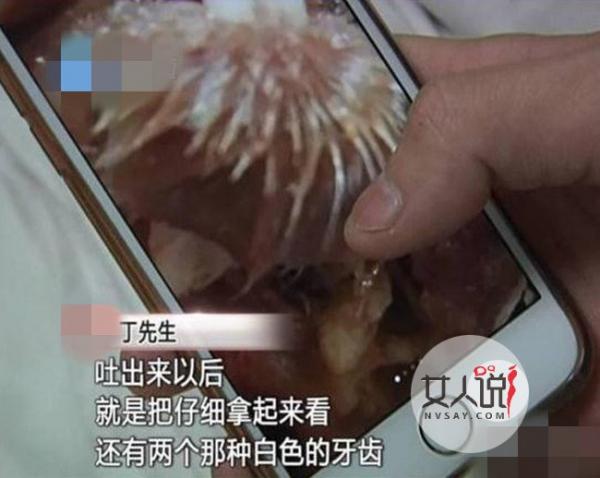 黄焖鸡吃出老鼠头 食安问题层出不穷让食客直呼伤不起