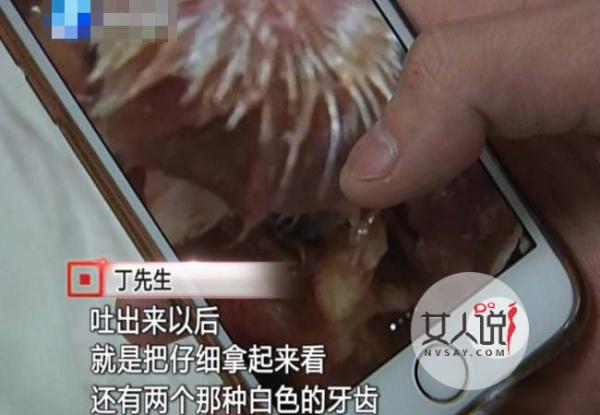 黄焖鸡吃出带牙肉 吃货男调查真相后干呕不止生无可恋