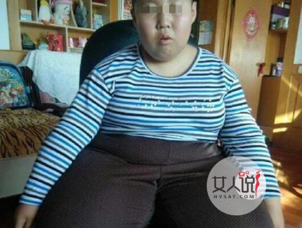 10岁男孩182斤 小胖孩莫名肥胖饱受折磨病因太离奇