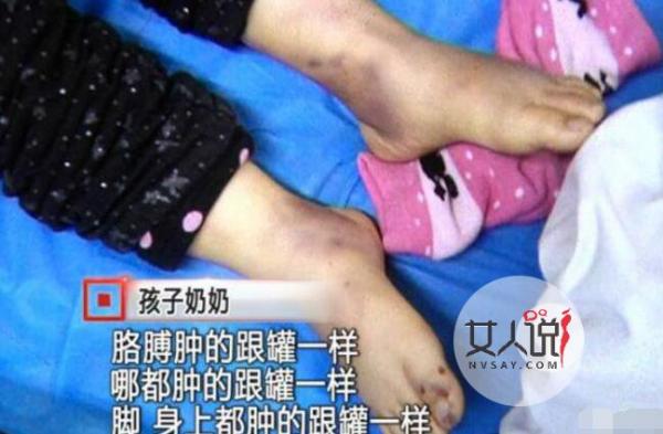 亲近奶奶被妈虐死 恶毒母亲竟如此残忍对待亲闺女