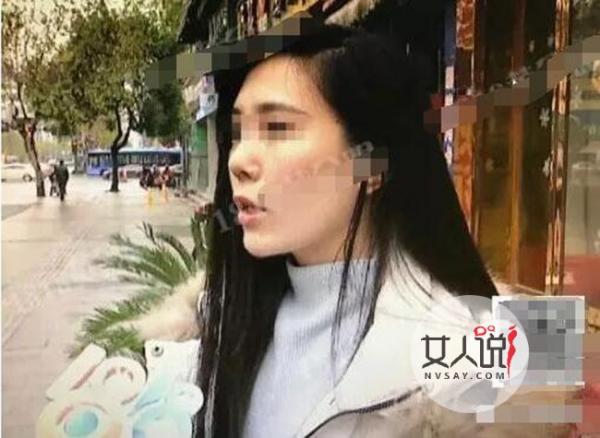 姑娘为整容打掉肚里孩子 姑娘爱美整容需谨慎毁容毁终生