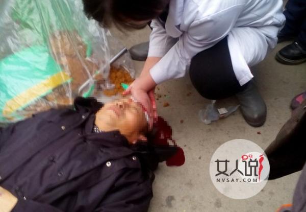 医生驾车撞倒老人 视若无睹淡定离去很心寒事件始末曝光