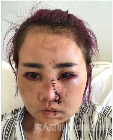 女子缝针