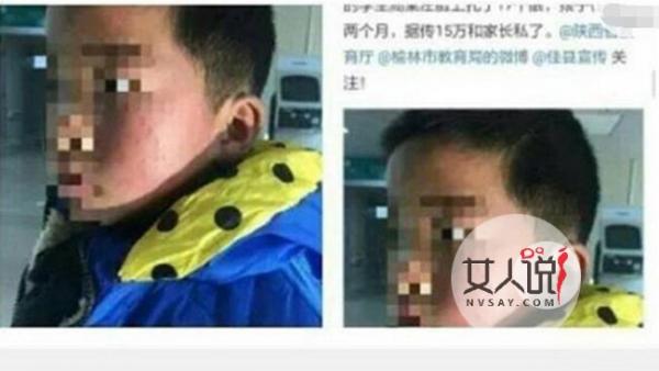 校长用笔扎学生脸 男孩脸上被扎得很恐怖照片曝光