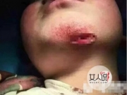 女子虐打男童被拘 男童被打得像猪头让人看得触目惊心