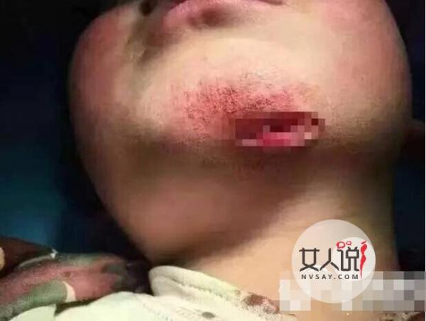 女子虐打男童被拘 男童被打得像猪头让人看得触目惊心