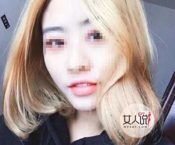 90后女孩闹市被撞垂危 花容月貌被毁奄奄一息躺病床