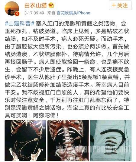 科普