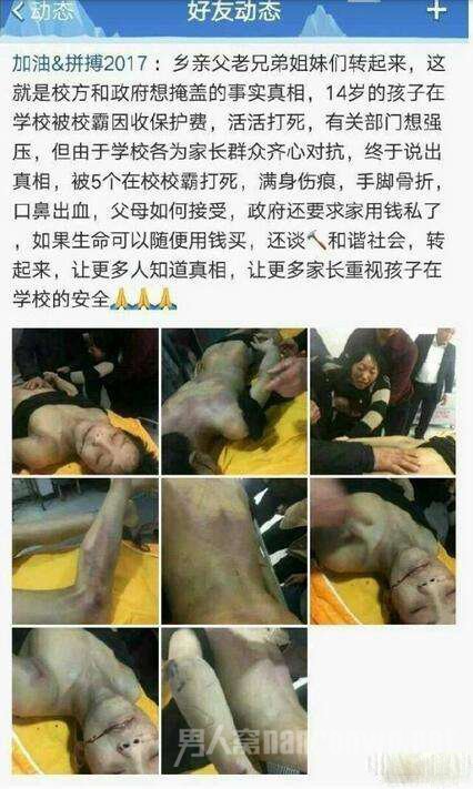 死者死亡检查