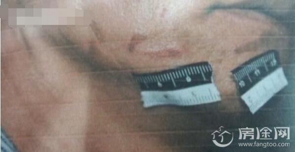 男子欲强奸独身妇女反被虐