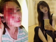 女星被砸得头破血流 她第一反应竟是上传自拍