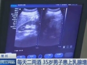 江苏一35岁男子每天喝二两白酒 患上乳腺增生