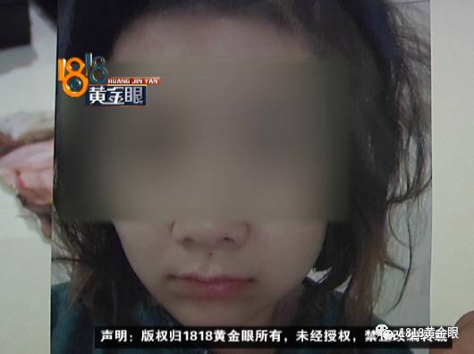 隆胸没效果被离婚