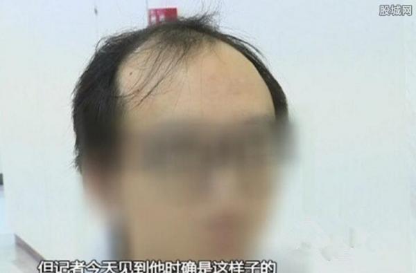 广东小伙长期熬夜