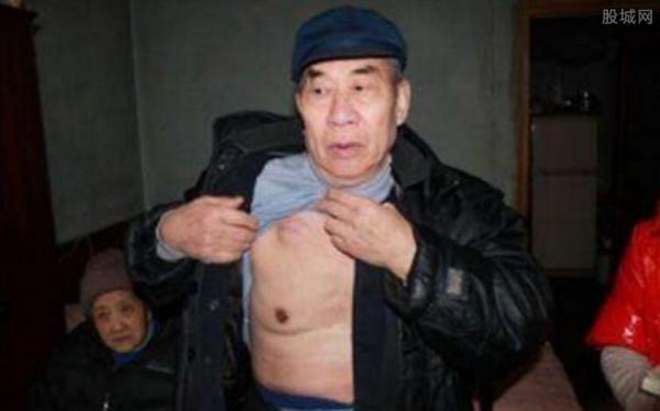 男性也患乳腺癌