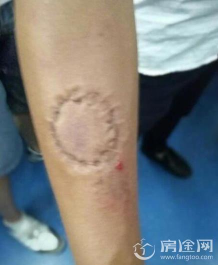 地铁色狼咬伤民警获刑：中年男裸露下体对女孩做不雅动作（图）